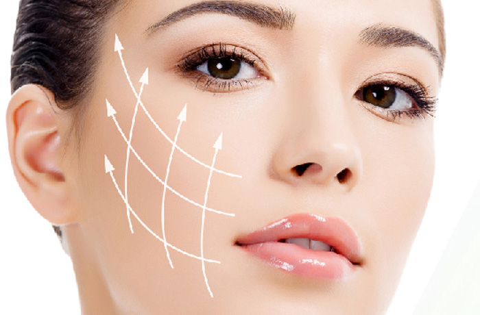 IMPLANTES FACIALES