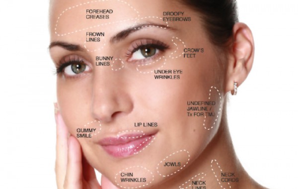 Fillers